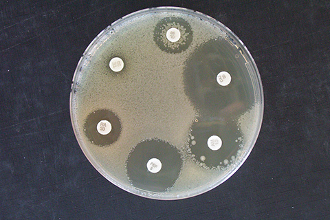 Identification de microorganismes par séquençage d’ADN / Antibiorésistance Identification de microorganismes par séquençage d’ADN / Antibiorésistance