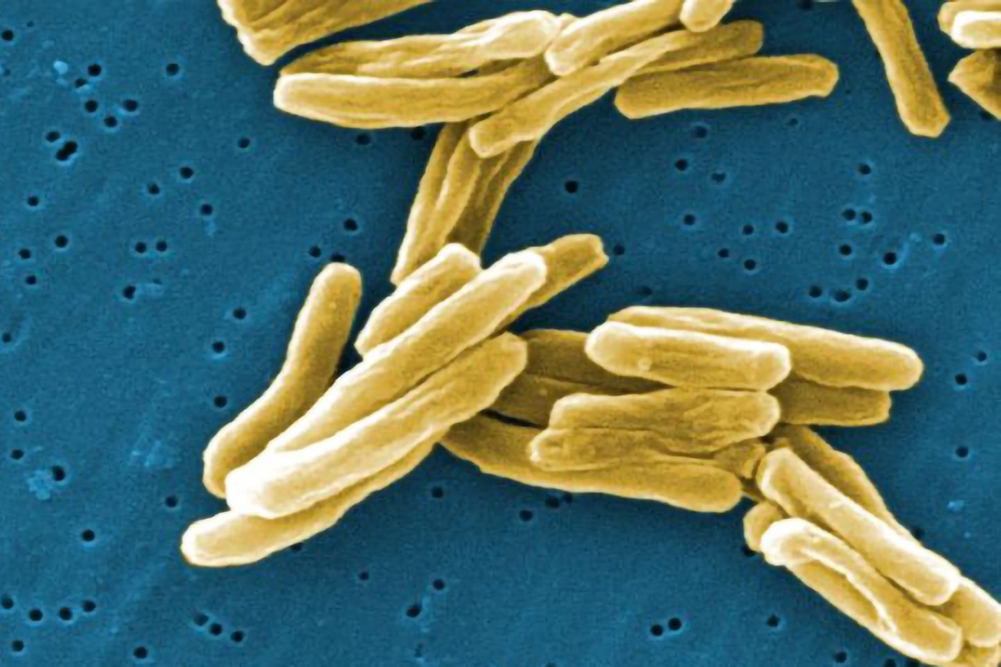 GenoScreen, the world leader in tuberculosis genotyping GenoScreen, the world leader in tuberculosis genotyping